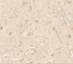 Invitrogen IL1F6 Polyclonal Antibody 100 &mu;g; Unconjugated:Antibodies,