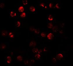 Invitrogen DNM1L Polyclonal Antibody 100 &mu;g; Unconjugated:Antibodies,
