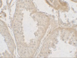 Invitrogen GLIPR1L2 Polyclonal Antibody 100 &mu;g; Unconjugated:Antibodies,