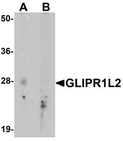 Invitrogen GLIPR1L2 Polyclonal Antibody 100 &mu;g; Unconjugated:Antibodies,