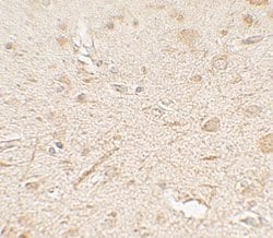 Invitrogen LAMTOR3 Polyclonal Antibody 100 &mu;g; Unconjugated:Antibodies,