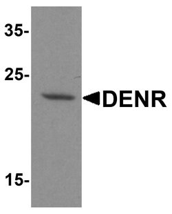 Invitrogen DENR Polyclonal Antibody 100 &mu;g; Unconjugated:Antibodies,