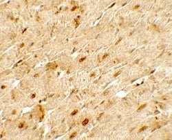 Invitrogen ANGPTL3 Polyclonal Antibody 100 &mu;g; Unconjugated:Antibodies,