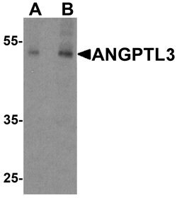 Invitrogen ANGPTL3 Polyclonal Antibody 100 &mu;g; Unconjugated:Antibodies,