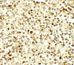 Invitrogen NOX4 Polyclonal Antibody 100 &mu;g; Unconjugated:Antibodies,