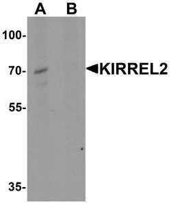 Invitrogen KIRREL2 Polyclonal Antibody 100 &mu;g; Unconjugated:Antibodies,