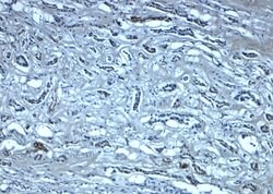 Invitrogen Nephrin Polyclonal Antibody 100 &mu;g; Unconjugated:Antibodies,