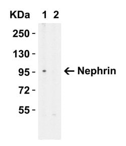 Invitrogen Nephrin Polyclonal Antibody 100 &mu;g; Unconjugated:Antibodies,