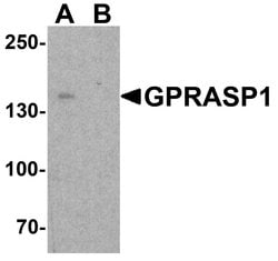 Invitrogen Beclin 2 Polyclonal Antibody 100 &mu;g; Unconjugated:Antibodies,