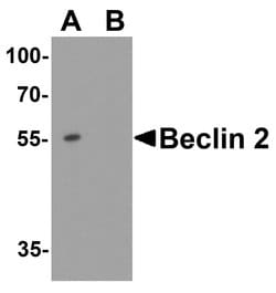 Invitrogen WWC1 Polyclonal Antibody 100 &mu;g; Unconjugated:Antibodies,