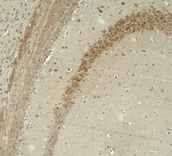 Invitrogen IQSEC2 Polyclonal Antibody 100 &mu;g; Unconjugated:Antibodies,