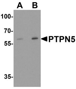 Invitrogen STEP Polyclonal Antibody 100 &mu;g; Unconjugated:Antibodies,