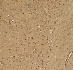 Invitrogen KCNK1 Polyclonal Antibody 100 &mu;g | Buy Online | Invitrogen&trade; | Fisher Scientific