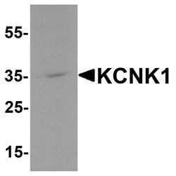 Invitrogen KCNK1 Polyclonal Antibody 100 &mu;g | Buy Online | Invitrogen&trade; | Fisher Scientific