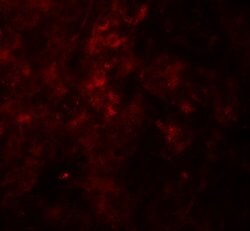 Invitrogen SESN2 Polyclonal Antibody 100 &mu;g; Unconjugated:Antibodies,
