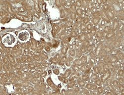 Invitrogen SESN2 Polyclonal Antibody 100 &mu;g; Unconjugated:Antibodies,