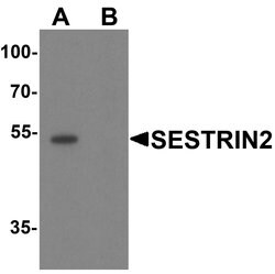 Invitrogen SESN2 Polyclonal Antibody 100 &mu;g; Unconjugated:Antibodies,
