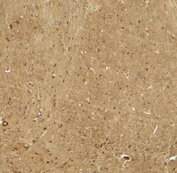 Invitrogen RHOT1 Polyclonal Antibody 100 &mu;g; Unconjugated:Antibodies,