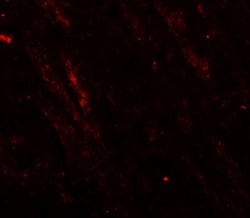 CaV3.2 Polyclonal Antibody:Antibodies, Polyclonal