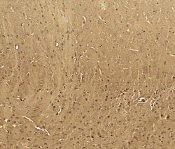 CaV3.2 Polyclonal Antibody:Antibodies, Polyclonal