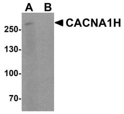 CaV3.2 Polyclonal Antibody:Antibodies, Polyclonal