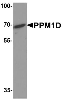 Invitrogen PPM1D Polyclonal Antibody 100 &mu;g; Unconjugated:Antibodies,