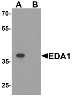 Invitrogen EDA Polyclonal Antibody 100 &mu;g; Unconjugated:Antibodies,