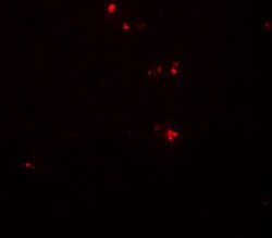 Invitrogen DTX4 Polyclonal Antibody 100 &mu;g; Unconjugated:Antibodies,