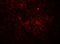 Jagged1 Polyclonal Antibody:Antibodies, Polyclonal