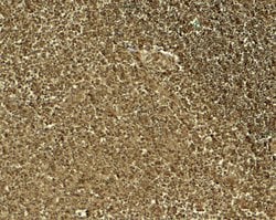 Jagged1 Polyclonal Antibody:Antibodies, Polyclonal