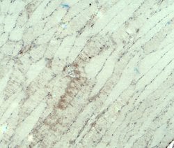 Invitrogen MYH3 Polyclonal Antibody 100 &mu;g; Unconjugated:Antibodies,