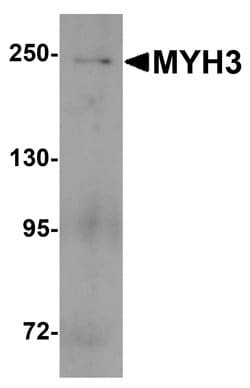 Invitrogen MYH3 Polyclonal Antibody 100 &mu;g; Unconjugated:Antibodies,