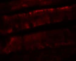 Invitrogen ADORA2B Polyclonal Antibody 100 &mu;g; Unconjugated:Antibodies,