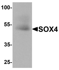Invitrogen SOX4 Polyclonal Antibody 100 &mu;g | Buy Online | Invitrogen&trade; | Fisher Scientific
