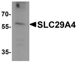 Invitrogen PMAT Polyclonal Antibody 100 &mu;g; Unconjugated:Antibodies,