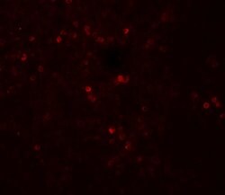 Invitrogen SNRPN Polyclonal Antibody 100 &mu;g; Unconjugated:Antibodies,