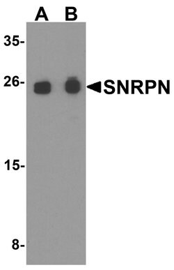 Invitrogen SNRPN Polyclonal Antibody 100 &mu;g; Unconjugated:Antibodies,