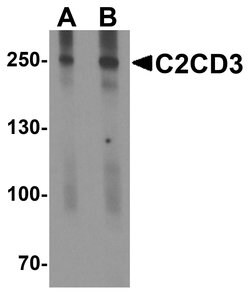 C2CD3 Polyclonal Antibody, Invitrogen 100 &mu;g; Unconjugated:Antibodies,