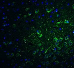PACS1 Polyclonal Antibody:Antibodies, Polyclonal