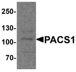 PACS1 Polyclonal Antibody:Antibodies, Polyclonal