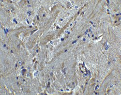 Invitrogen PACS2 Polyclonal Antibody 100 &mu;g; Unconjugated:Antibodies,
