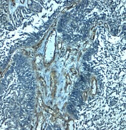 Invitrogen PALMD Polyclonal Antibody 100 &mu;g; Unconjugated:Antibodies,