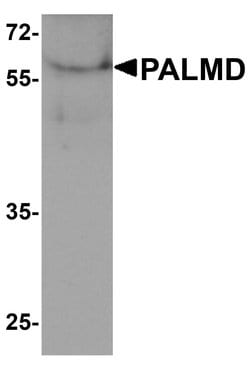 Invitrogen PALMD Polyclonal Antibody 100 &mu;g; Unconjugated:Antibodies,