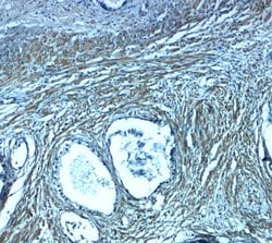 PMEPA1 Polyclonal Antibody:Antibodies, Polyclonal