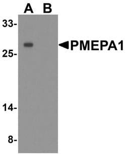 PMEPA1 Polyclonal Antibody:Antibodies, Polyclonal