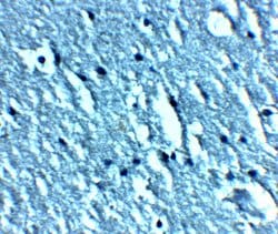 Invitrogen TRPC3 Polyclonal Antibody 100 &mu;g; Unconjugated:Antibodies,