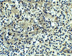 Invitrogen DEPDC1B Polyclonal Antibody 100 &mu;g; Unconjugated:Antibodies,