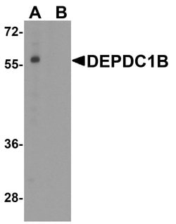 Invitrogen DEPDC1B Polyclonal Antibody 100 &mu;g; Unconjugated:Antibodies,