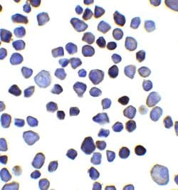 Invitrogen&trade;&nbsp;INPP4B Polyclonal Antibody