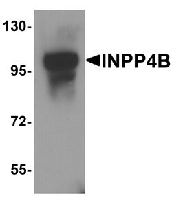 Invitrogen INPP4B Polyclonal Antibody 100 &mu;g | Buy Online | Invitrogen&trade; | Fisher Scientific